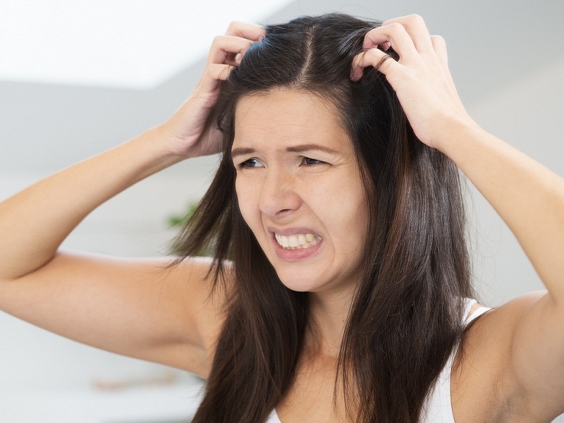 Home Remedies For Dandruff