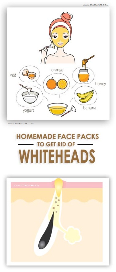 Face Packs for Whiteheads