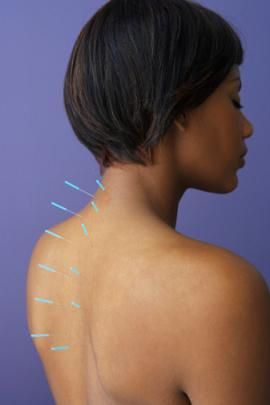 Acupressure Points for Weight Loss