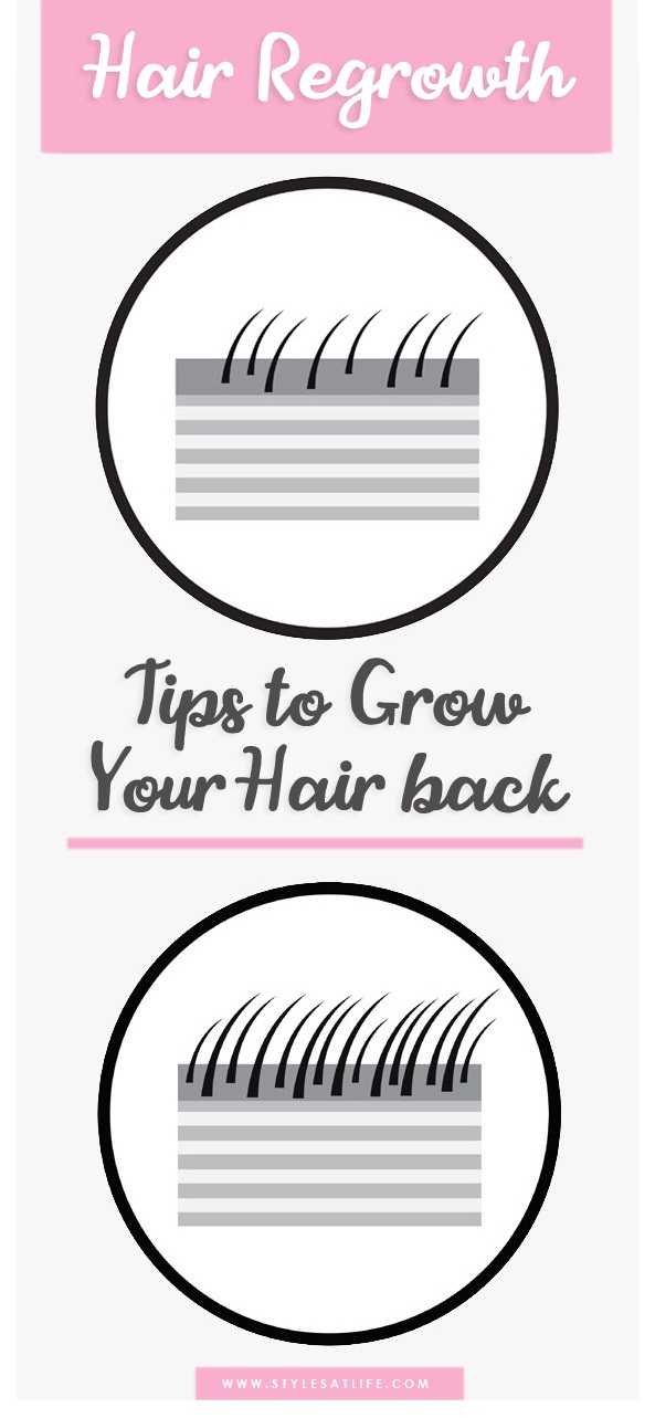 Tips to Regrow You Hair