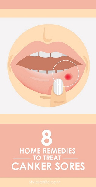 home remedies for canker sores