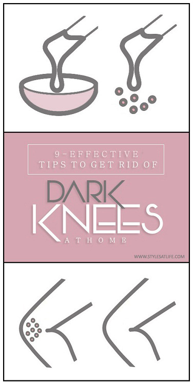 Tips to Get Rid of Dark Knees