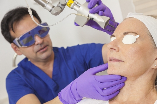 Laser Treatment for Dark Circles