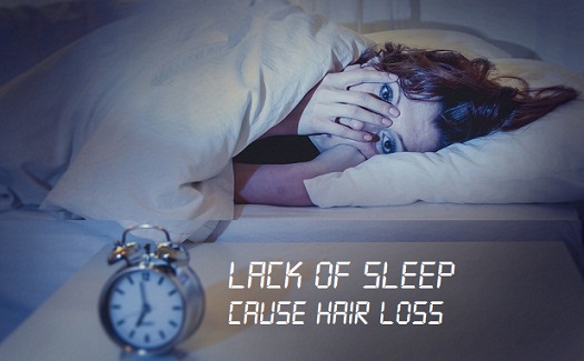 lack-of-sleep-hair-loss