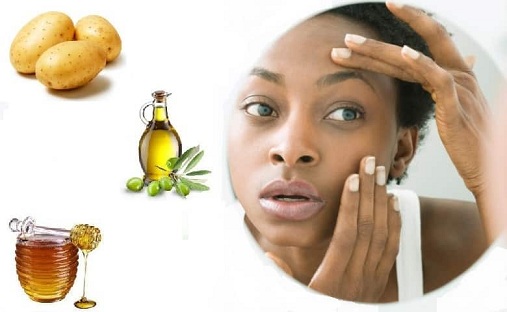 Potato and Honey Mask for Dark Circles