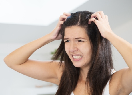 Hair itchy Dandruff2