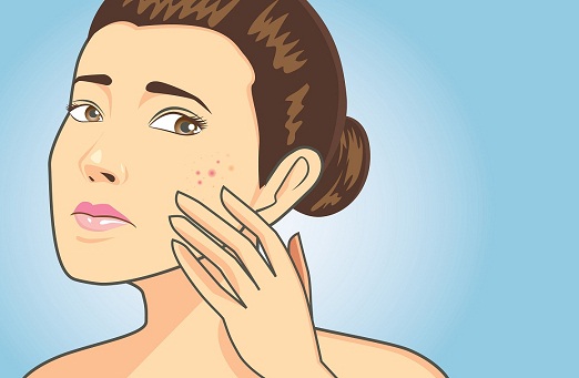 How To Remove Dark Spots From Face Within 2 Days