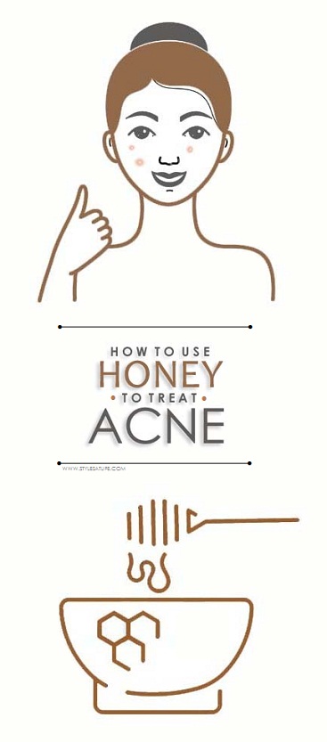 honey for acne