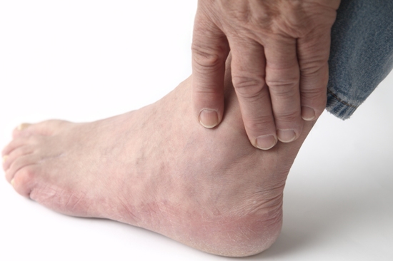 Symptoms of Gout