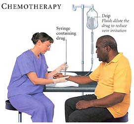 Chemotherapy